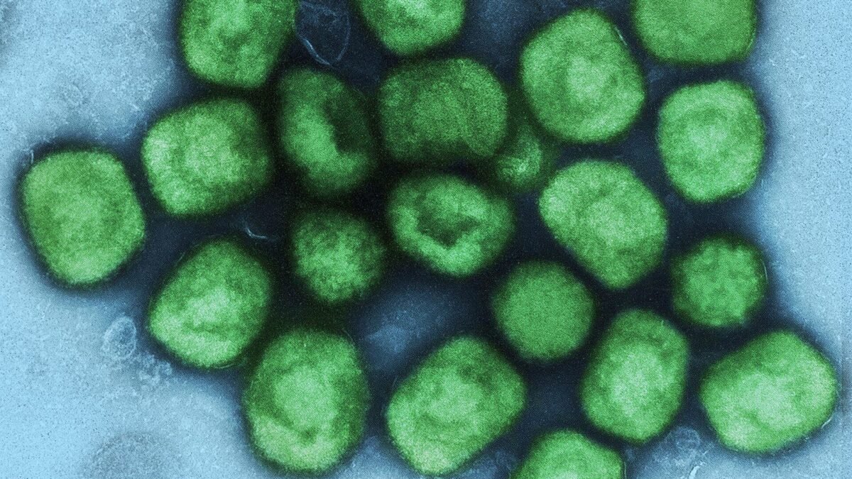 Rio tem 74 casos de mpox em dois meses e capital está sem doses da vacina
