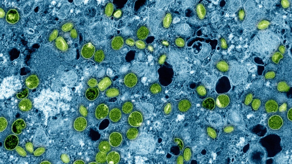 Mpox: sintomas, como pega e quem pode tomar a vacina no SUS
