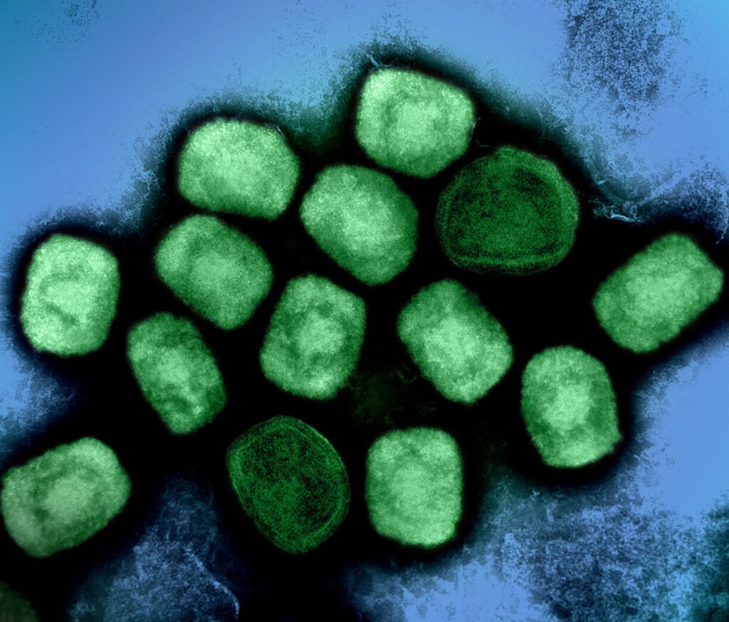 Vírus da mpox em imagem de microscopia